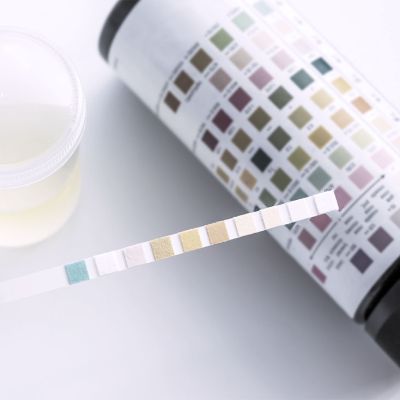 Drug Testing in the Workplace